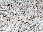 FCGR2A / CD32a Antibody in Immunohistochemistry (Paraffin) (IHC (P))