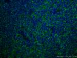 HLA-E Antibody in Immunohistochemistry (PFA fixed) (IHC (PFA))