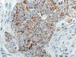 MRPL45 Antibody in Immunohistochemistry (Paraffin) (IHC (P))
