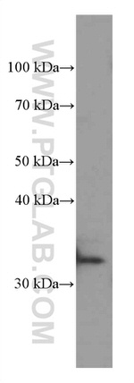 MRPL45 Antibody in Western Blot (WB)