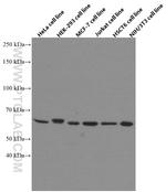 AMPK alpha Antibody in Western Blot (WB)