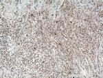 Calponin 1 Antibody in Immunohistochemistry (Paraffin) (IHC (P))
