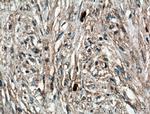 Calponin 1 Antibody in Immunohistochemistry (Paraffin) (IHC (P))
