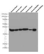 Calponin 1 Antibody in Western Blot (WB)