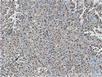 TOP2A Antibody in Immunohistochemistry (Paraffin) (IHC (P))