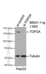 TOP2A Antibody in Western Blot (WB)