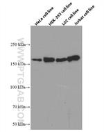 TOP2A Antibody in Western Blot (WB)