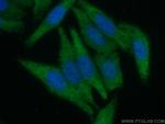 TWIST2 Antibody in Immunocytochemistry (ICC/IF)