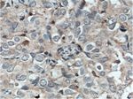 TWIST2 Antibody in Immunohistochemistry (Paraffin) (IHC (P))