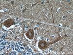 Huntingtin Antibody in Immunohistochemistry (Paraffin) (IHC (P))