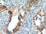 HE4 Antibody in Immunohistochemistry (Paraffin) (IHC (P))