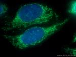 TOMM22 Antibody in Immunocytochemistry (ICC/IF)
