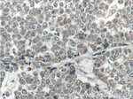 TOMM22 Antibody in Immunohistochemistry (Paraffin) (IHC (P))