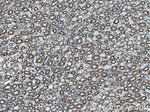 TOMM22 Antibody in Immunohistochemistry (Paraffin) (IHC (P))