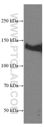 LATS1 Antibody in Western Blot (WB)
