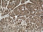 GRP78/BIP Antibody in Immunohistochemistry (Paraffin) (IHC (P))