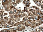 GRP78/BIP Antibody in Immunohistochemistry (Paraffin) (IHC (P))