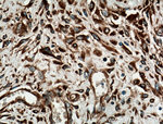 GRP78/BIP Antibody in Immunohistochemistry (Paraffin) (IHC (P))