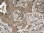 GRP78/BIP Antibody in Immunohistochemistry (Paraffin) (IHC (P))