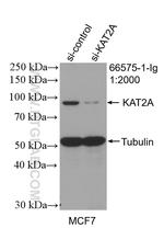 KAT2A/GNC5 Antibody in Western Blot (WB)