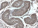 GTDC1 Antibody in Immunohistochemistry (Paraffin) (IHC (P))