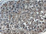 GTDC1 Antibody in Immunohistochemistry (Paraffin) (IHC (P))