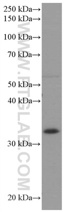 AMPK beta 2 Antibody in Western Blot (WB)