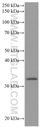 AMPK beta 2 Antibody in Western Blot (WB)
