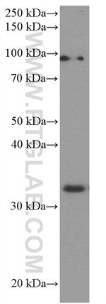 AMPK beta 2 Antibody in Western Blot (WB)