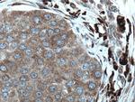 STT3A Antibody in Immunohistochemistry (Paraffin) (IHC (P))