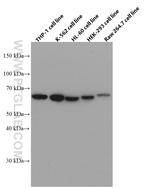 STT3A Antibody in Western Blot (WB)