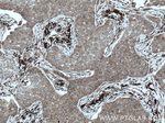 STT3A Antibody in Immunohistochemistry (Paraffin) (IHC (P))