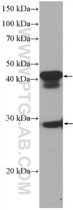 DNAJB6 Antibody in Western Blot (WB)