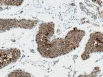 EGLN1 Antibody in Immunohistochemistry (Paraffin) (IHC (P))