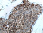 EGLN1 Antibody in Immunohistochemistry (Paraffin) (IHC (P))