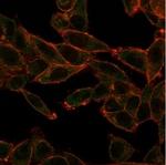 SOX4 (Master Regulator of Epithelial-Mesenchymal Transition) Monoclonal Antibody (PCRP-SOX4-1D6)