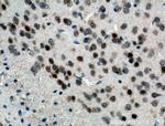 FOS Antibody in Immunohistochemistry (Paraffin) (IHC (P))