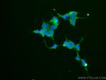 RAF1 Antibody in Immunocytochemistry (ICC/IF)