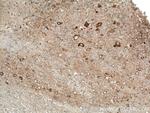 TOM70 Antibody in Immunohistochemistry (Paraffin) (IHC (P))