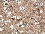 TOM70 Antibody in Immunohistochemistry (Paraffin) (IHC (P))