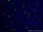 MAdCAM1 Antibody in Immunohistochemistry (PFA fixed) (IHC (PFA))