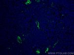 MAdCAM1 Antibody in Immunohistochemistry (PFA fixed) (IHC (PFA))