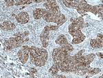 MRPL23 Antibody in Immunohistochemistry (Paraffin) (IHC (P))