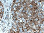 MRPL23 Antibody in Immunohistochemistry (Paraffin) (IHC (P))