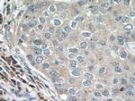 ACAP1 Antibody in Immunohistochemistry (Paraffin) (IHC (P))