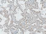 P4HA2 Antibody in Immunohistochemistry (Paraffin) (IHC (P))
