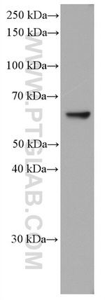 P4HA2 Antibody in Western Blot (WB)