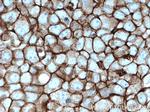 FYN Antibody in Immunohistochemistry (Paraffin) (IHC (P))
