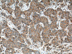 FYN Antibody in Immunohistochemistry (Paraffin) (IHC (P))