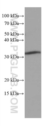 MMACHC Antibody in Western Blot (WB)